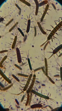 Microscopic view of numerous small, segmented arthropods, possibly springtails, on a light background.