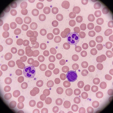 Microscopic view of human blood cells red blood cells neutrophils and a lymphocyte