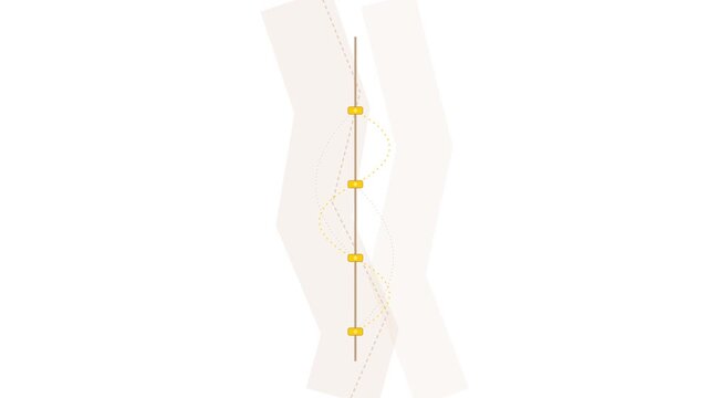 Subsurface Electrical Resistivity Tomography Logging String with Dipole Current Pulses