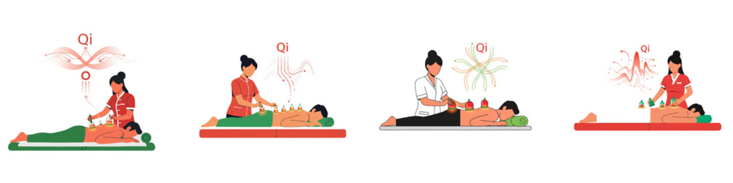 Cupping therapy flat vector illustration set showing alternative medicine treatment steps on transparent background