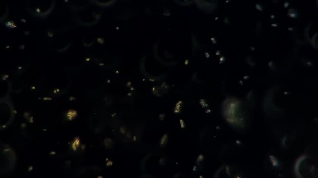 Gut microbiota probiotics under darkfield microscope - Lactic acid bacteria and yeast in fermented milk kefir 
