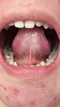 Close up of the lingual frenulum, illustrating oral anatomy, speech therapy exercises and tongue mobility assessment.