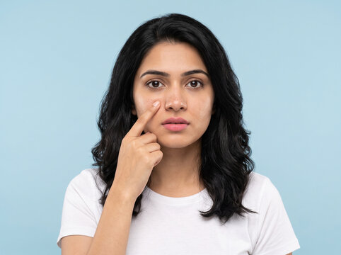 young indian woman touching face while checking early stage clogged and congested pores for dermatology facial cleansing advertising banner poster