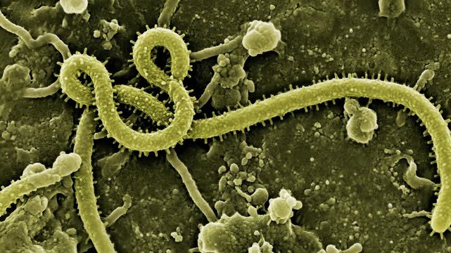 Microscopic filovirus particle: Ebola virus, infectious agent, disease threat, viral pathogen, deadly contagion, microscopic structure, cell invader, medical biology, danger organism, human health.