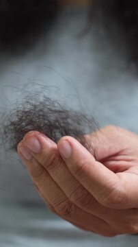 young woman her hair and have many hair loss. problem of maintenance losing by sad strain cancer patients after receiving chemotherapy. Healthcare and medical concept.