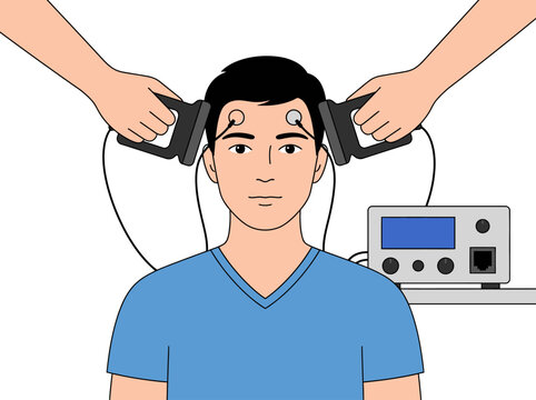 Man Receiving Brain Stimulation Therapy Vector Illustration - Neurological Treatment Concept