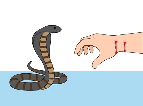 Cobra Snake Bite Illustration with Bleeding Fang Marks on Human Hand - Venomous Snake Attack Medical Concept Vector
