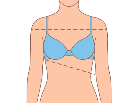 Illustration of Uneven Shoulders and Bra Fit Issues with Measurement Lines for Body Posture Analysis