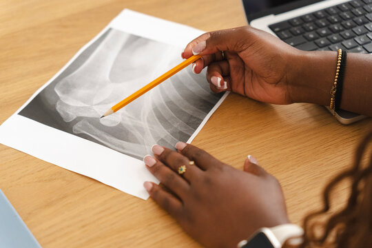 A Black female medical professional sits at a wooden desk and uses a yellow pencil to carefully examine a bone x-ray printout. A modern laptop keyboard is visible nearby.