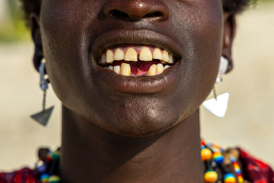 Extreme close-up of the smiling mouth and chin of a Maasai man with gapped teeth wearing triangle pendant earrings and a colorful bead necklace in warm sunlight, Jambiani, Tanzania