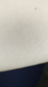 A mosquito resting and biting on human skin