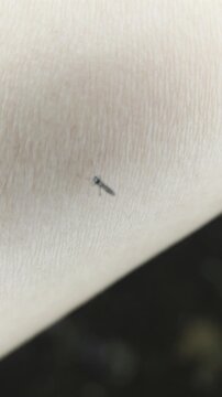 A mosquito resting and biting on human skin