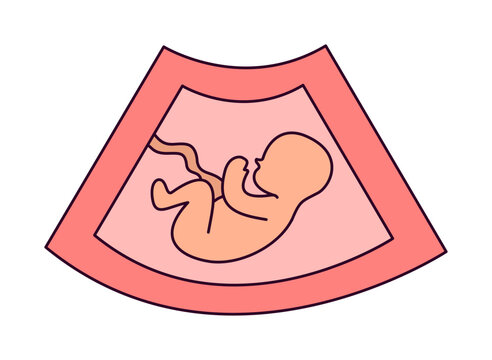 Colorful ultrasound scan showing unborn baby fetus in womb