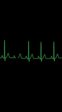 Normal sinus rhythm ECG heart monitor trace vertical video loop