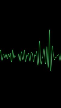 Ventricular fibrillation cardiac arrest ECG vertical video loop