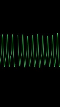 Ventricular tachycardia ECG monitor trace vertical video loop