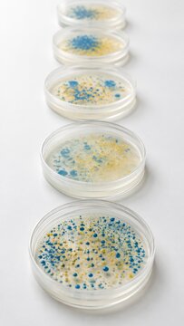 Row of petri dishes with blue and yellow bacteria colonies on white background, antimicrobial resistance concept, medical science laboratory research