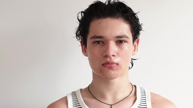 Problem skin and acne in puberty for dermatology ads, serious teenager with curly hair and real skin in striped tank top on white background. Problem skin portrait, teen looks at camera