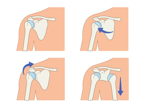 Types of Shoulder Dislocation Medical Illustration Showing Anterior Posterior and Inferior Joint Displacement with Humerus and Scapula Anatomy