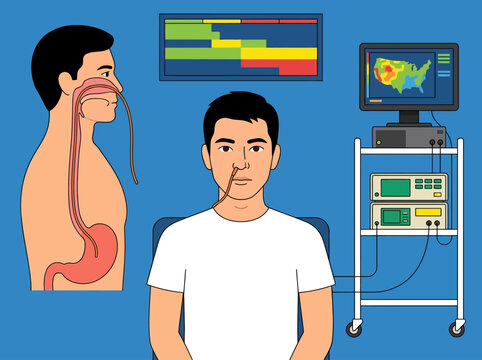 Medical Illustration of Esophageal Manometry or pH Study Procedure with Patient Anatomy and Diagnostic Equipment