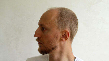 Side profile portrait of man with aquiline nose before rhinoplasty plastic surgery © eliyashevskiy