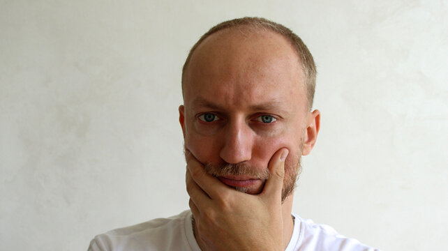 Close-up of young man head top view with male pattern baldness and receding hairline