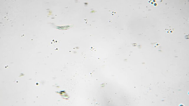Marine protist displays characteristic motile actions and feeding traces observed. Single celled marine organism demonstrates distinctive locomotion and feeding patterns under microscopy observation