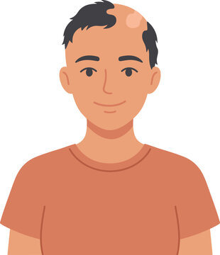 Smiling young man with short dark hair and a receding hairline with a small bald patch, wearing an orange t-shirt
