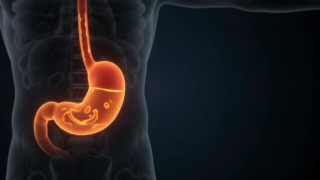 Human Stomach Acid Reflux - Heartburn Burning Sensation in Esophagus - 3D Medical Animation Anatomy Footage