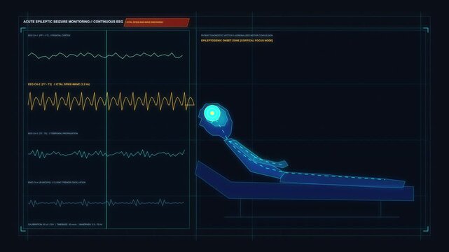 Medical HUD interface animation showing patient monitoring and brain scan