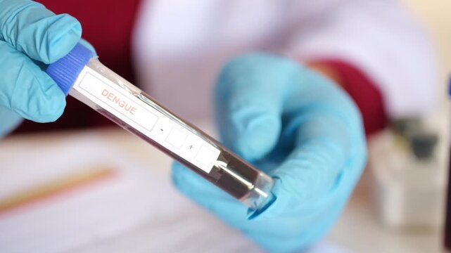 A doctor or laboratory technician holds a test tube containing a blood sample from a patient with Dengue fever; a medical and healthcare concept. Efforts regarding the treatment and prevention of Deng