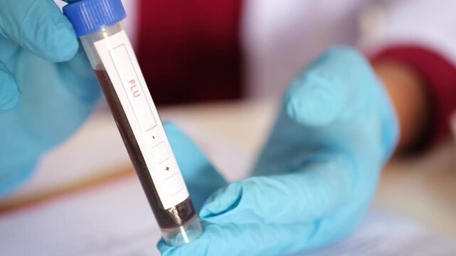 A doctor holds a blood sample from a flu patient; a lab test is used to determine the diagnosis.
