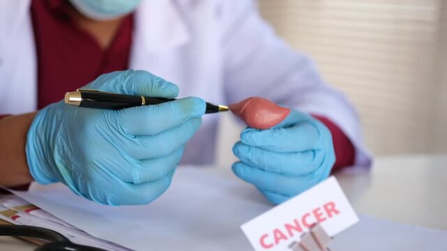 Liver cancer concept: A doctor holds a model of human liver anatomy and explains it to a patient. Liver cancer care and treatment.