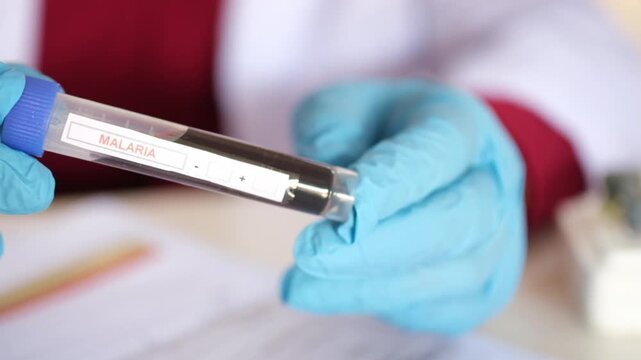 Doctor hold Blood sample for Salmonella test. Healthcare and medical concept. Salmonella bacteria or typhoid test.