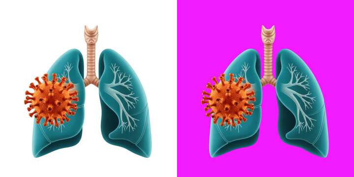 Human lungs infected with virus cells 3D digital for medical research transparent background, png