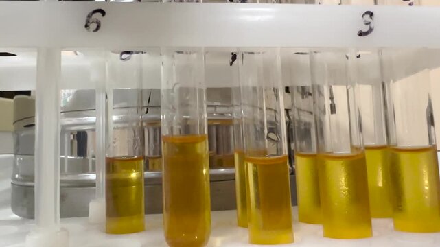 Closeup of doctor placing test tubes with samples into rack box