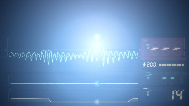 Defibrillator Shock Restoring Heart Rhythm on Patient Monitor Animation