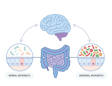 Gut brain axis illustration showing normal and abnormal intestinal microbiota with digestive system and brain