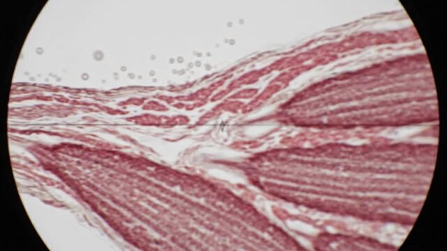 Microscopic view of skeletal muscle tissue stained for laboratory research analysis.