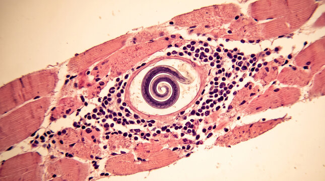 Trichinella spiralis larva encysted in infected mammalian skeletal muscle tissue under microscope magnification view