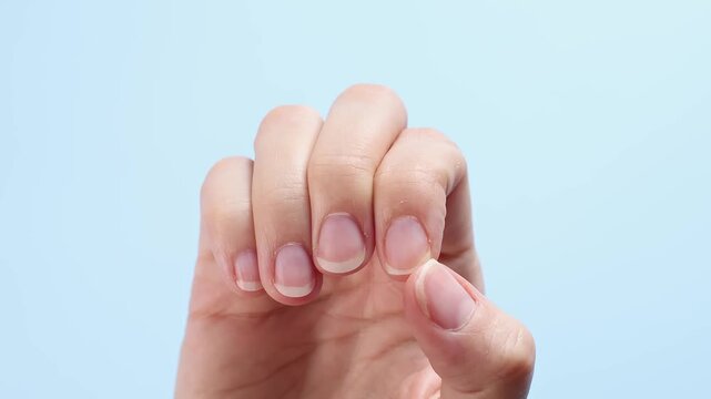 Close-up of broken fingernails on female hand. Hand shows damaged nails and bend fingers revealing the split. Nail care, manicure and personal hygiene concept. Light blue background. Real time footage