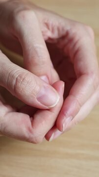 Close-up of broken fingernails on woman hands. Hands show a damaged nails and bend fingers to reveal the split. Concept of nail care, manicure and personal hygiene. Vertical real time footage.