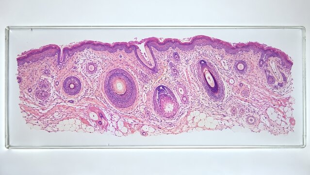 Hair Follicle Biopsy Showing Cycle Stage Structure in a Pathology Lab