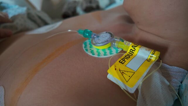 Medical electrode and cable rest on a child chest during hospital monitoring
