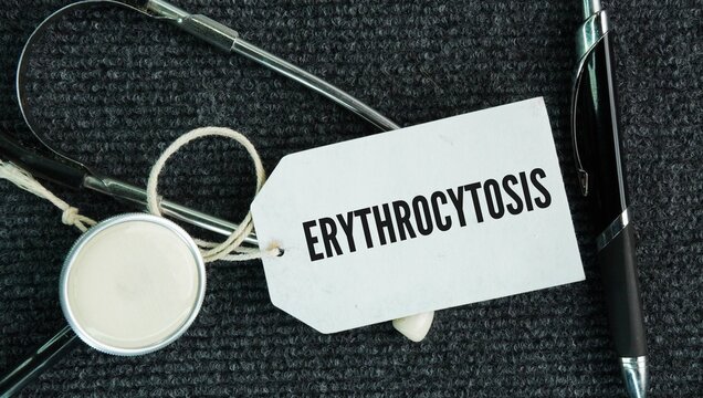 Stethoscope and paper tag with the word Erythrocytosis is a medical condition defined by an abnormally high concentration or mass of red blood cells, resulting in elevated hemoglobin or hematocrit lev