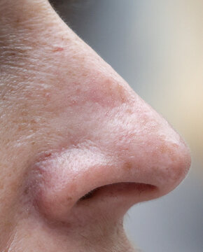 Close-up of human nose in profile view