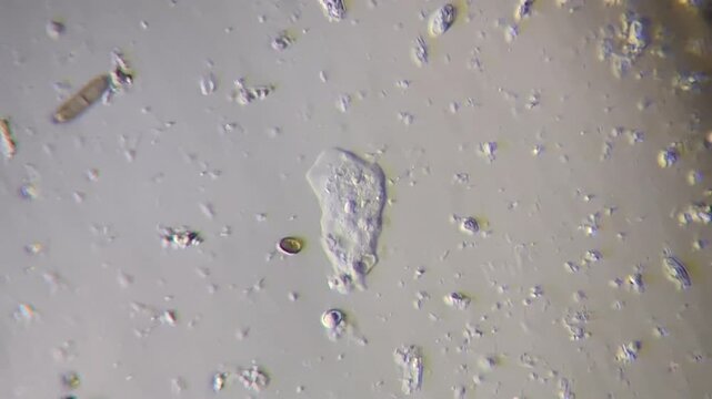 Amoeba single-celled organism moving under microscope with pseudopods in freshwater