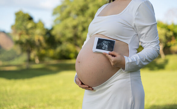 Expectant mother holding an ultrasound image beside her baby bump outdoors in a sunny park