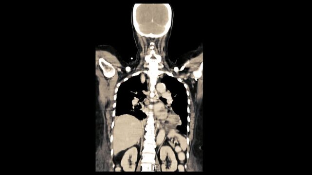 Body mri Imaging or ct scan of x-ray body shows Internal Organs and Liver,Lungs,Intestines,Stomach,Bladder,Kidneys.
