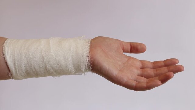 Close-up of a human hand with a medical bandage around the wrist after an injury or sprain. A white gauze bandage is securely fixed on the skin of the forearm. The concept of medicine, healthcare
